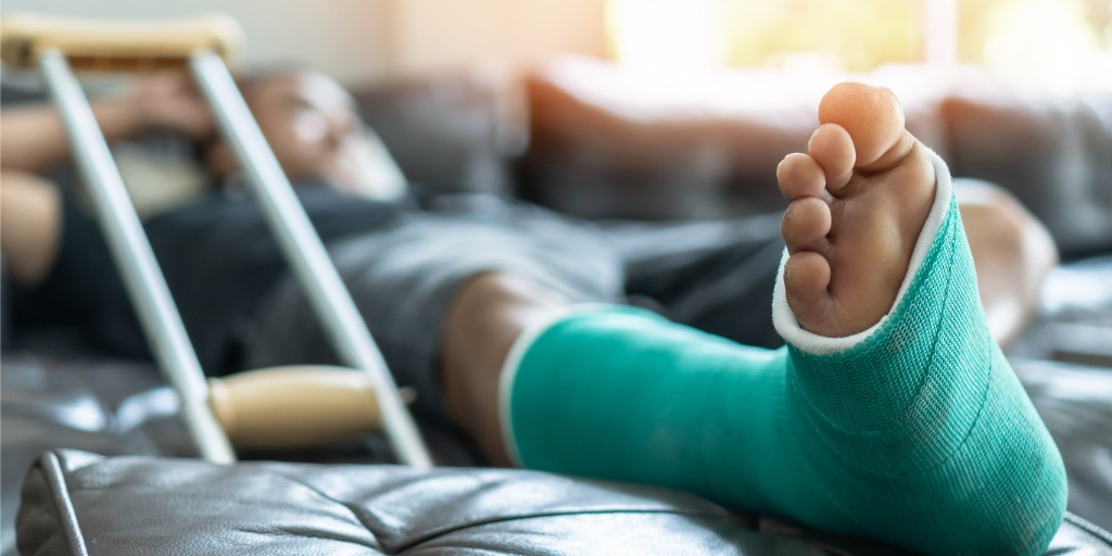 Legal support for victims of broken bones and fractures in Milwaukee.