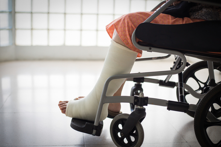 Legal support for victims of broken bones and fractures in Milwaukee.